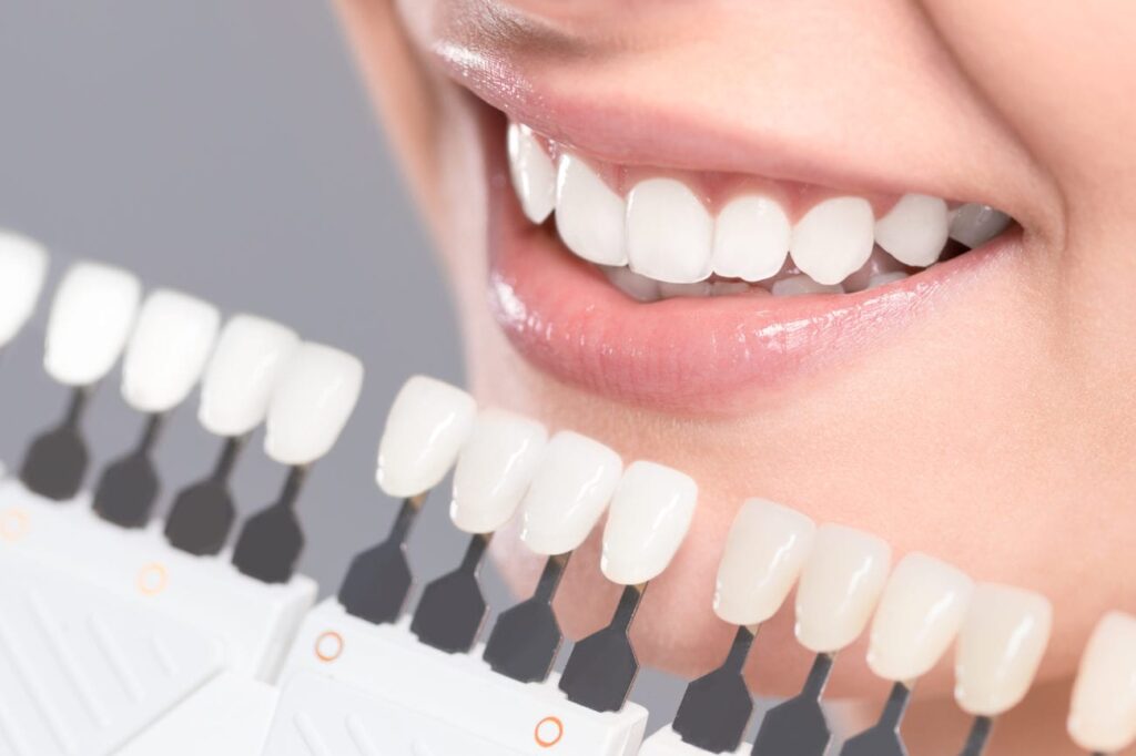 fixing discolored teeth at your morristown nj dentist